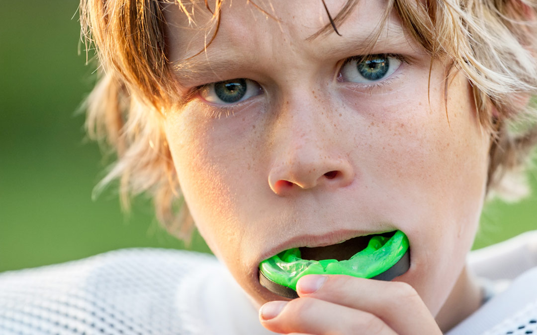 The importance (and profit center) of mouthguards